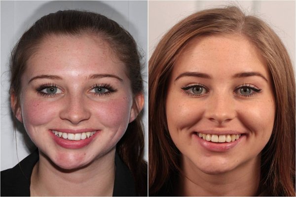 glenview dental treatment
